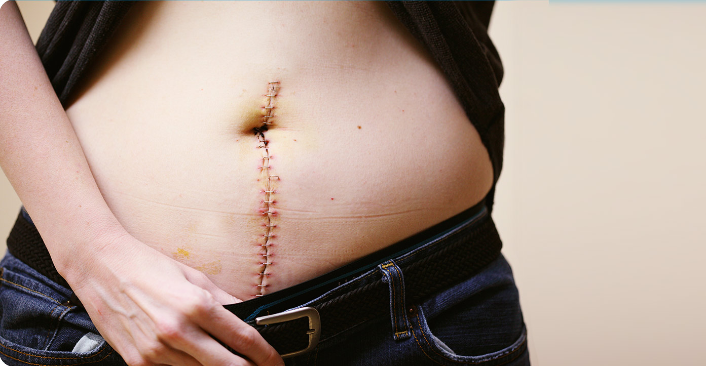 Vorbereitung zur Bauch-OP